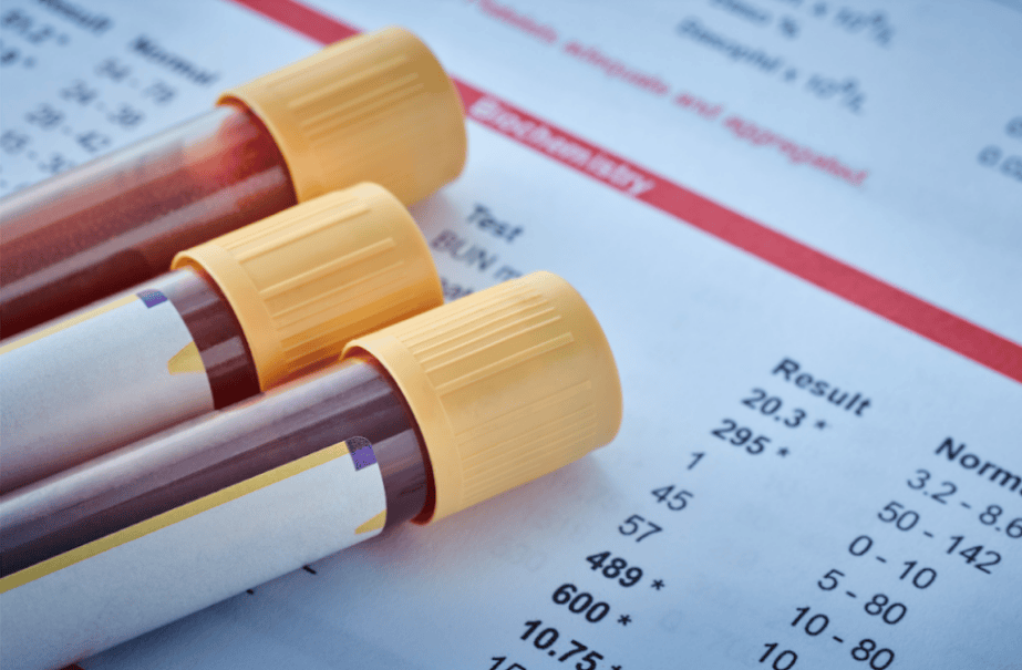 What’s in a Blood Test? Understanding Chem 10, Chem 17, CBC & When ...